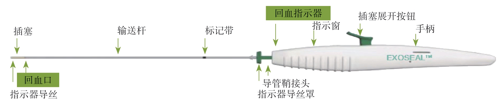 模拟器训练在实施股动脉穿刺点ExoSeal<sup>TM</sup>封堵止血系统操作的